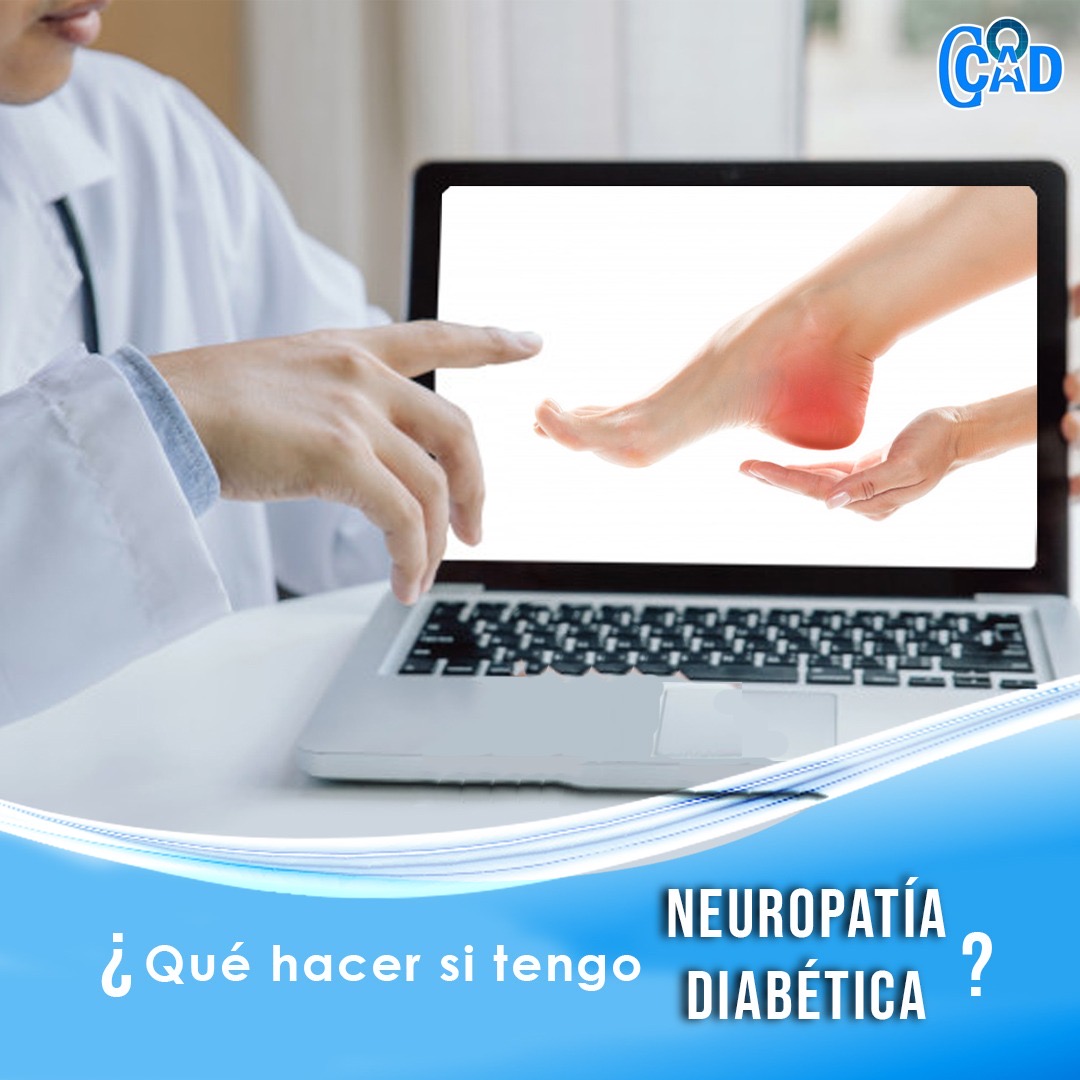  Neuropatía Diabética?