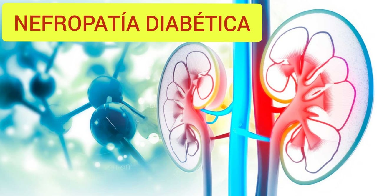RECOMENDACIONES BÁSICAS PARA PREVENIR LA NEFROPATÍA DIABÉTICA